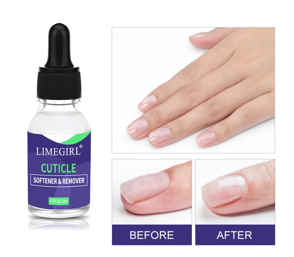 LIMEGIRL 15ml Nail Care Cuticle Regenerating Oil Preventative Nail